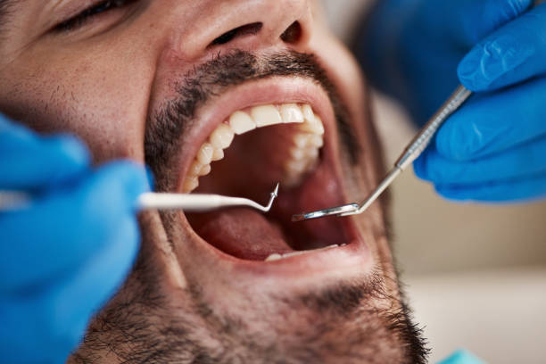 Best Root Canal Emergency Dentist  in Auburn, KS